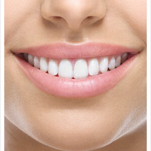 745da8f65a9443d3892c870ae419abc2-tam_seramik_zirkonyum_destekli_restorasyonlar Zirkonyum Restorasyonlar